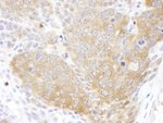 CCT5 Antibody in Immunohistochemistry (IHC)