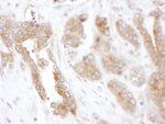 CCT5 Antibody in Immunohistochemistry (IHC)