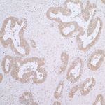 CCT7 Antibody in Immunohistochemistry (IHC)