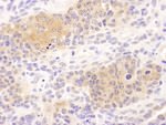 CCT8 Antibody in Immunohistochemistry (IHC)