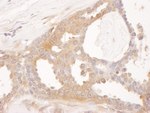 CCT8 Antibody in Immunohistochemistry (IHC)