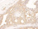 CCT8 Antibody in Immunohistochemistry (IHC)