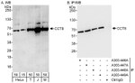 CCT8 Antibody in Western Blot (WB)