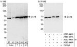 CCT8 Antibody in Western Blot (WB)