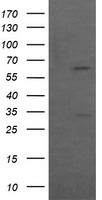 CCT8L2 Antibody in Western Blot (WB)