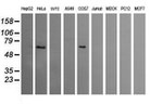 CCT8L2 Antibody in Western Blot (WB)