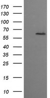 CCT8L2 Antibody in Western Blot (WB)