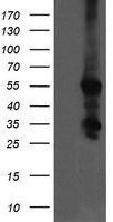 CCT8L2 Antibody in Western Blot (WB)