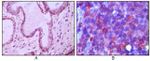 CD10 Antibody in Immunohistochemistry (Paraffin) (IHC (P))