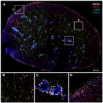 CD103 (Integrin alpha E) Antibody in Immunohistochemistry (IHC)