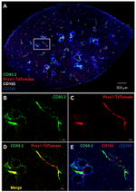 CD103 (Integrin alpha E) Antibody in Immunohistochemistry (IHC)