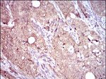 CD104 Antibody in Immunohistochemistry (Paraffin) (IHC (P))