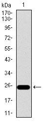 CD104 Antibody in Western Blot (WB)