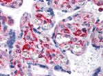 VCAM-1 Antibody in Immunohistochemistry (Paraffin) (IHC (P))