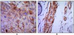 VCAM-1 Antibody in Immunohistochemistry (Paraffin) (IHC (P))