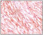 c-Kit Antibody in Immunohistochemistry (Paraffin) (IHC (P))