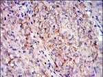 c-Kit Antibody in Immunohistochemistry (Paraffin) (IHC (P))