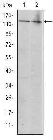 c-Kit Antibody in Western Blot (WB)