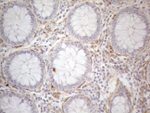 CD13 Antibody in Immunohistochemistry (Paraffin) (IHC (P))