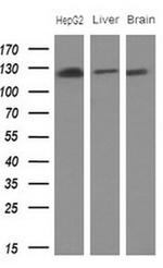 CD13 Antibody in Western Blot (WB)