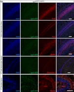 CD133 (Prominin-1) Antibody in Immunohistochemistry (IHC)