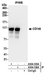 CD146 Antibody in Western Blot (WB)