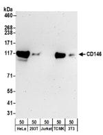 CD146 Antibody in Western Blot (WB)