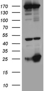 CD160 Antibody in Western Blot (WB)