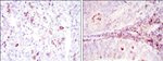 CD1a Antibody in Immunohistochemistry (Paraffin) (IHC (P))