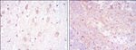 CD1a Antibody in Immunohistochemistry (Paraffin) (IHC (P))