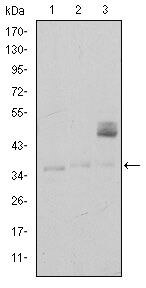 CD1a Antibody in Western Blot (WB)