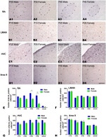 CD20 Antibody in Immunohistochemistry (IHC)