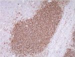 CD20 Antibody in Immunohistochemistry (Paraffin) (IHC (P))