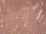 CD20 Antibody in Immunohistochemistry (Paraffin) (IHC (P))