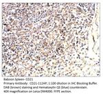 CD21 Antibody in Immunohistochemistry (IHC)