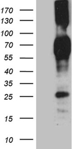 CD244 Antibody in Western Blot (WB)