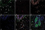 CD44 Antibody in Immunohistochemistry (IHC)