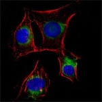 NGFR Antibody in Immunocytochemistry (ICC/IF)