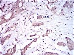 BMPR1A Antibody in Immunohistochemistry (Paraffin) (IHC (P))