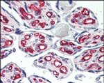 CD31 Antibody in Immunohistochemistry (Paraffin) (IHC (P))