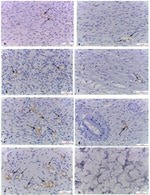 CD31 Antibody in Immunohistochemistry (IHC)