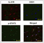 CD31 Antibody in Immunohistochemistry (IHC)