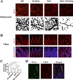 CD31 (PECAM-1) Antibody in Immunohistochemistry (IHC)