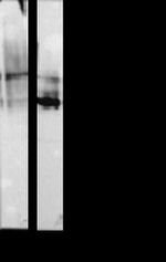 E-cadherin Antibody in Western Blot (WB)