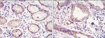 E-cadherin Antibody in Immunohistochemistry (Paraffin) (IHC (P))