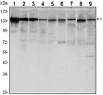 E-cadherin Antibody in Western Blot (WB)