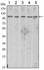 N-cadherin Antibody in Western Blot (WB)