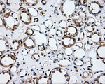 CD36 Antibody in Immunohistochemistry (Paraffin) (IHC (P))