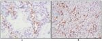 CD38 Antibody in Immunohistochemistry (Paraffin) (IHC (P))