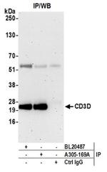 CD3D Antibody in Western Blot (WB)